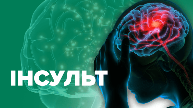 Порядок надання домедичної допомоги постраждалим при підозрі на гострий мозковий інсульт